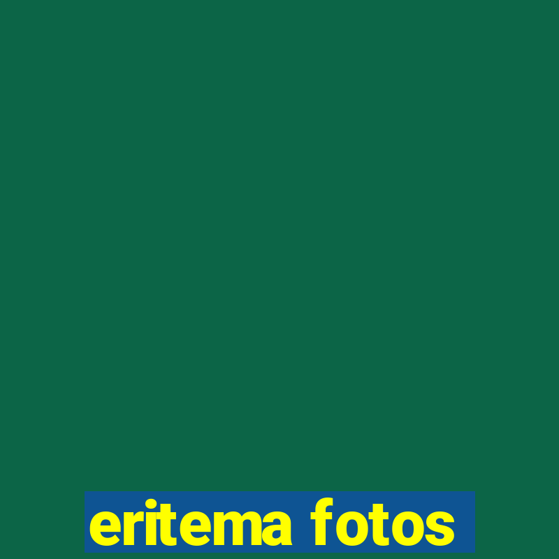 eritema fotos